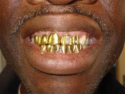 gold crowned teeth